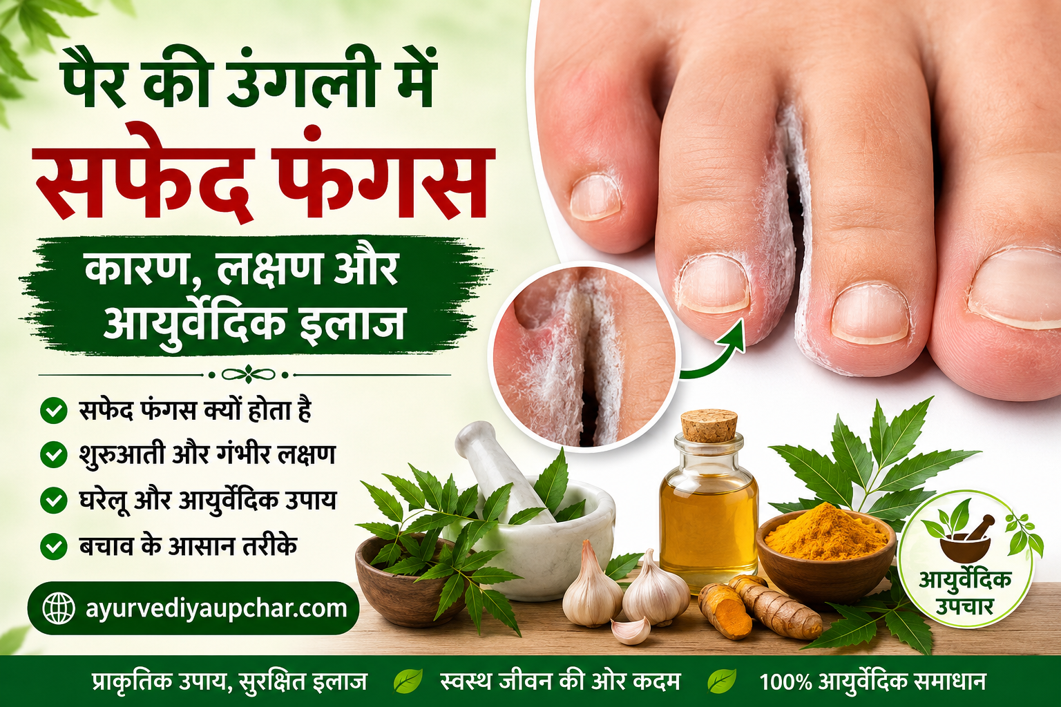 पैर की उंगली में सफेद फंगस का इलाज: कारण, लक्षण, घरेलू उपाय, आयुर्वेदिक उपचार और बचाव की पूरी जानकारी